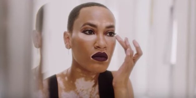 Cette mannequin atteinte de vitiligo est la nouvelle égérie d'une marque de maquillage