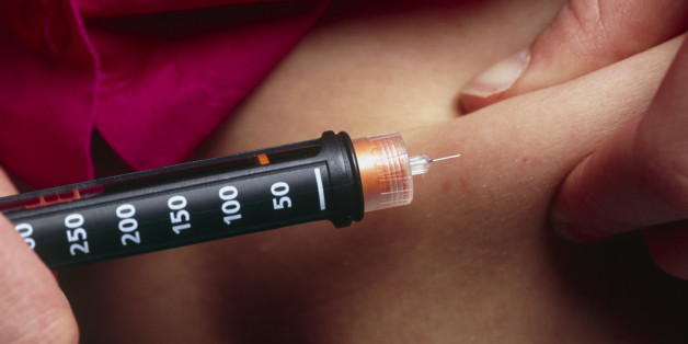 Insulin injection. 13-year-old girl injecting herself in the abdomen with insulin. She has diabetes mellitus. This is a disorder affecting glucose sugar metabolism, where the sugar is not oxidised due to a lack of the hormone insulin, secreted by the pancreas in healthy individuals. In diabetics, unused sugar accumulates in the blood and the urine. Fats are utilised as an alternative energy source, which leads to a build-up of ketones in the blood that may eventually cause convulsions and diabet