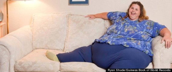 World S Fattest Man Loses 46 Stone And Needs Surgery To