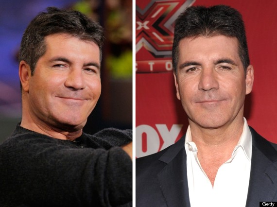 Simon Cowell Looks Puffy-Faced On Jay Leno's US Chat Show (PICS)