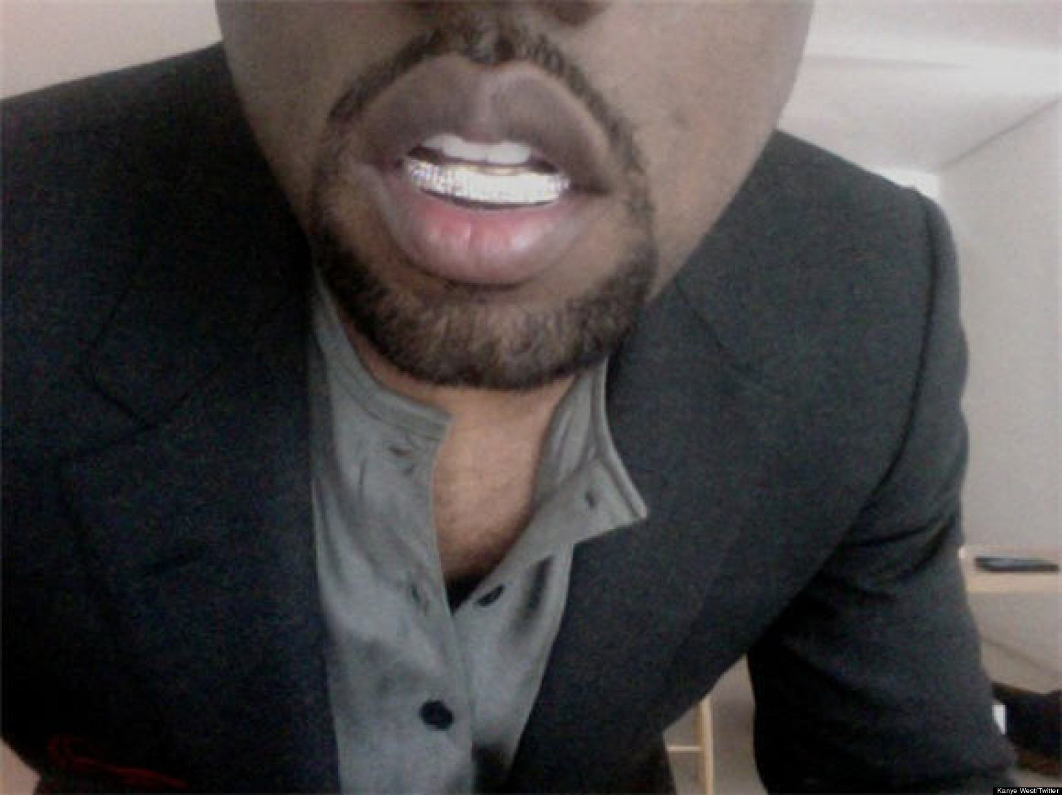 Kanye West's Diamond Teeth Is He Embarrassed By His Dental Decision