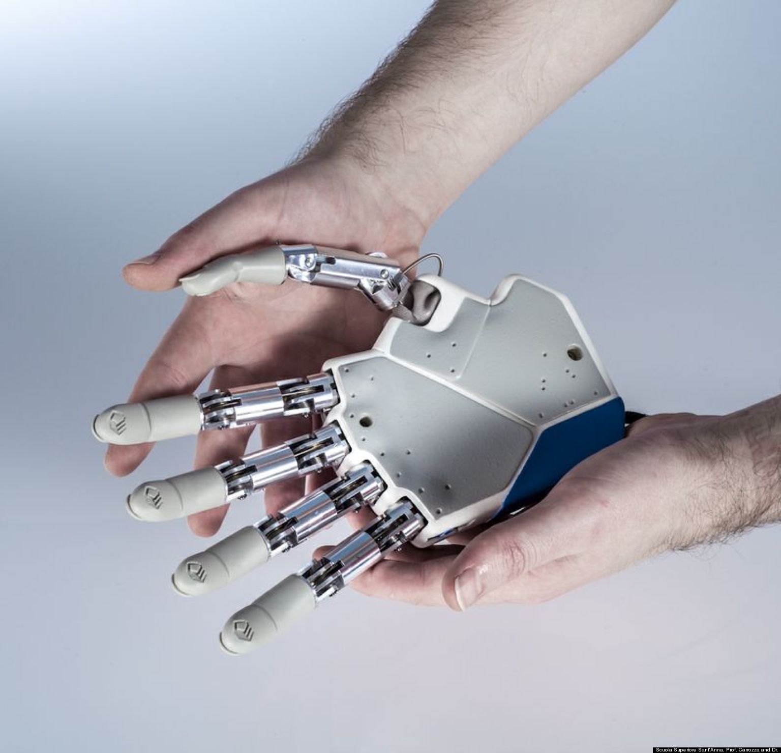 New Bionic Hand Prosthesis Called First To Give Amputees Sense Of Touch ...