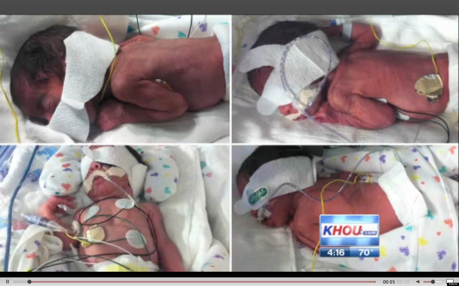 Tressa Montalvo, Texas Mother, Gives Birth To Two Sets Of Identical ...